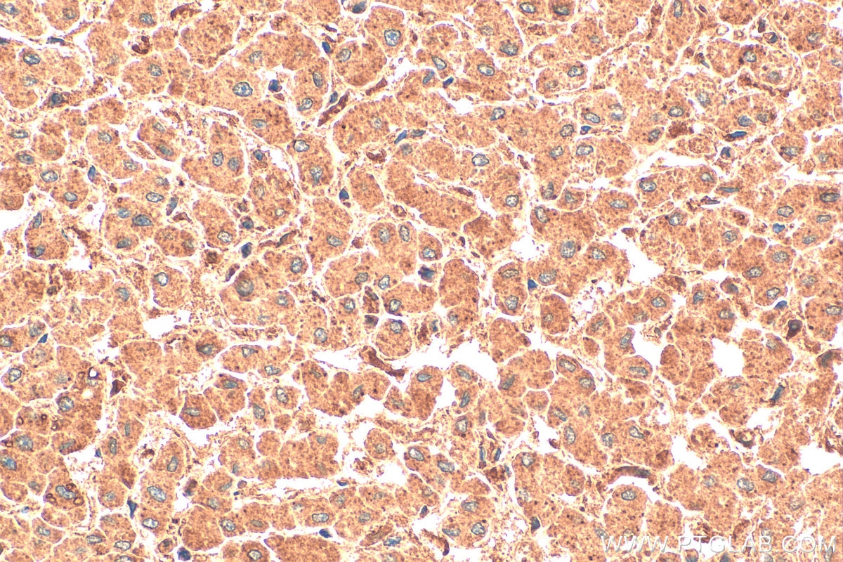 Immunohistochemistry (IHC) staining of human liver tissue using PFKFB3 Polyclonal antibody (13763-1-AP)