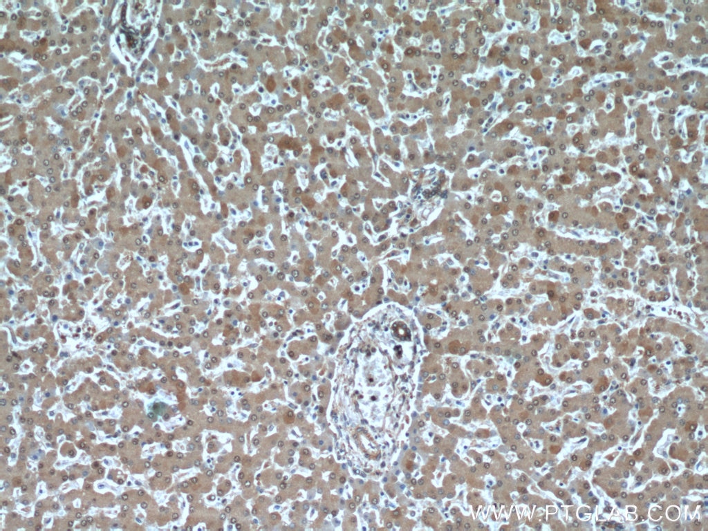 Immunohistochemistry (IHC) staining of human liver tissue using PFKFB3 Polyclonal antibody (13763-1-AP)