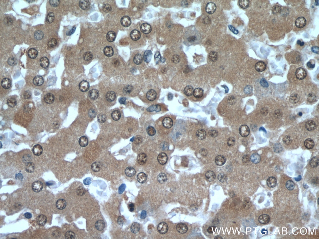 Immunohistochemistry (IHC) staining of human liver tissue using PFKFB3 Polyclonal antibody (13763-1-AP)
