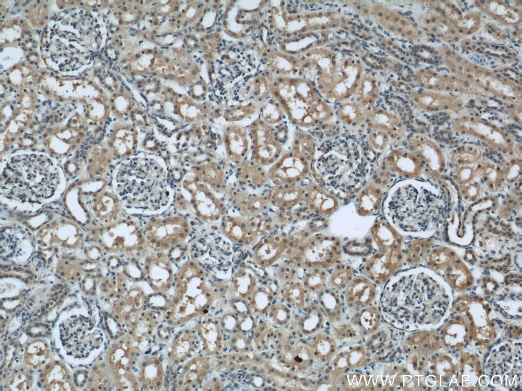 Immunohistochemistry (IHC) staining of human kidney tissue using PFKFB3 Polyclonal antibody (13763-1-AP)
