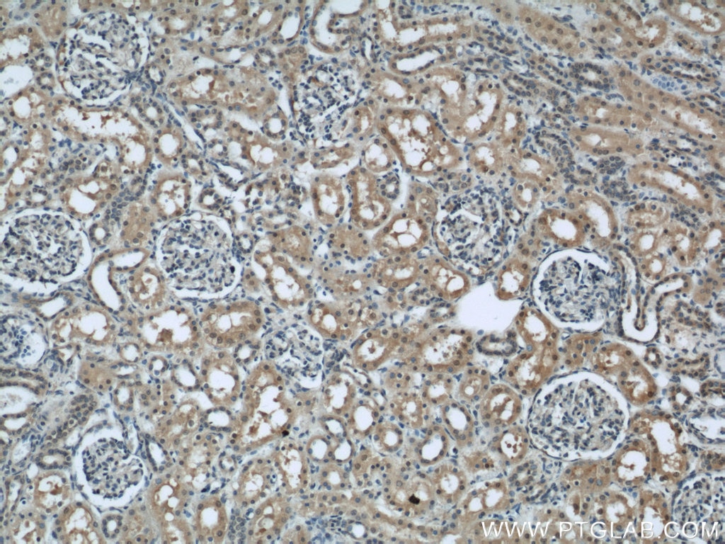 IHC staining of human kidney using 13763-1-AP