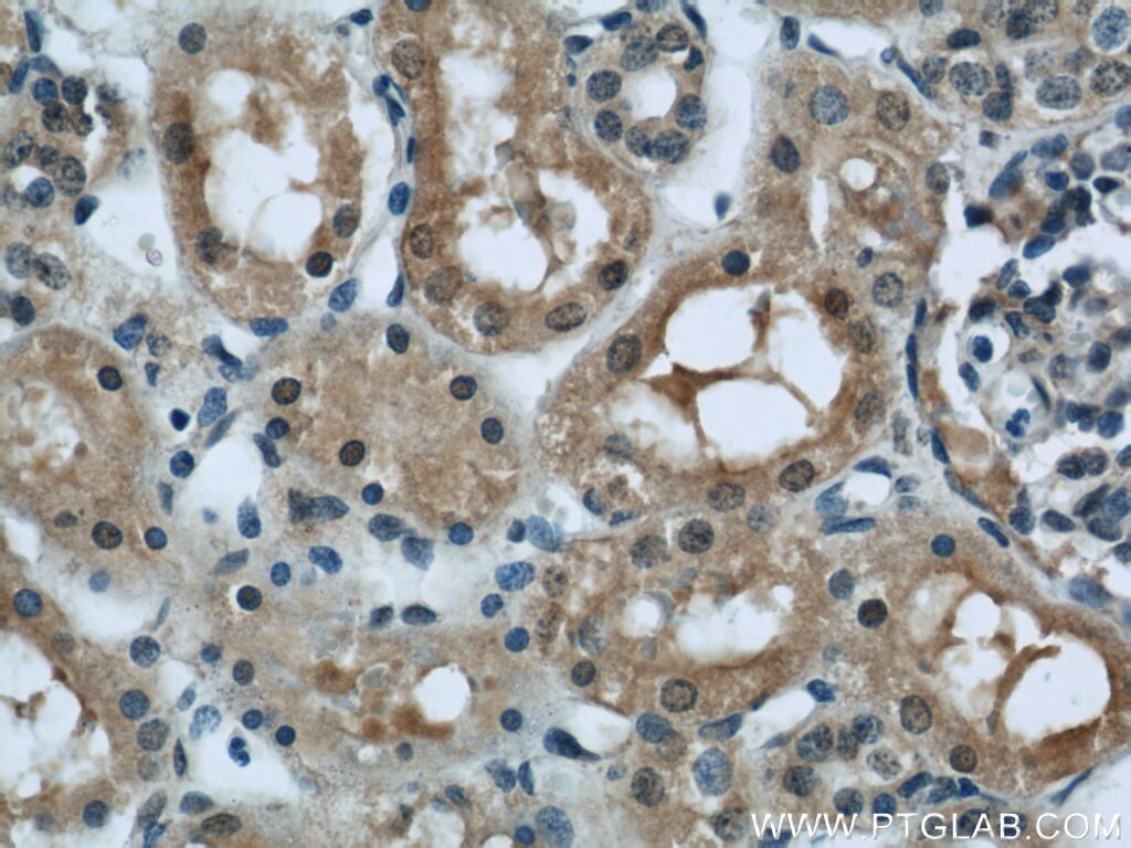 Immunohistochemistry (IHC) staining of human kidney tissue using PFKFB3 Polyclonal antibody (13763-1-AP)