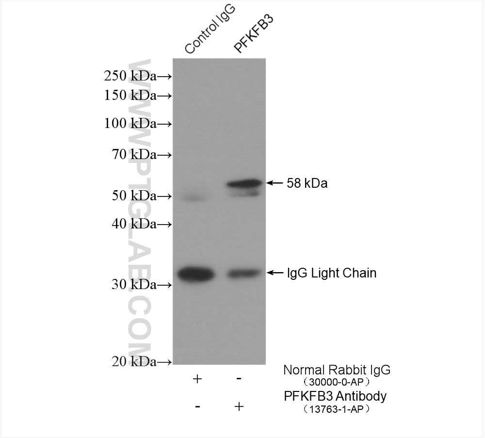 IP experiment of mouse spleen using 13763-1-AP