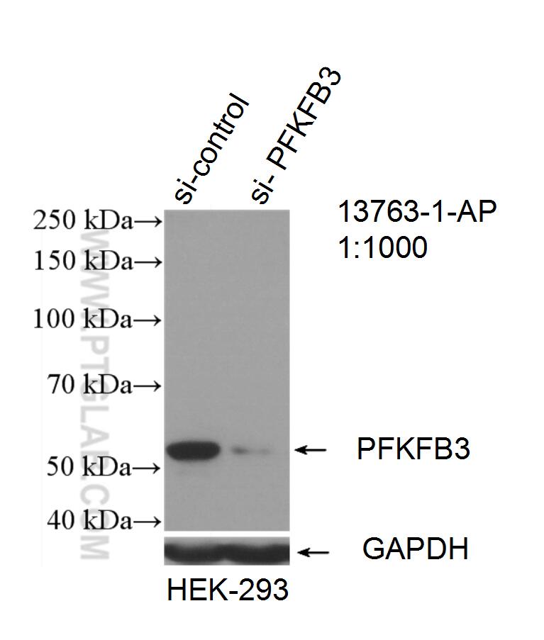 Western Blot (WB) analysis of HEK-293 cells using PFKFB3 Polyclonal antibody (13763-1-AP)