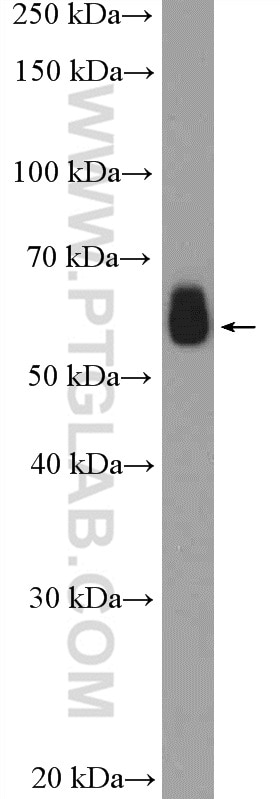 Western Blot (WB) analysis of mouse thymus tissue using PFKFB3 Polyclonal antibody (13763-1-AP)