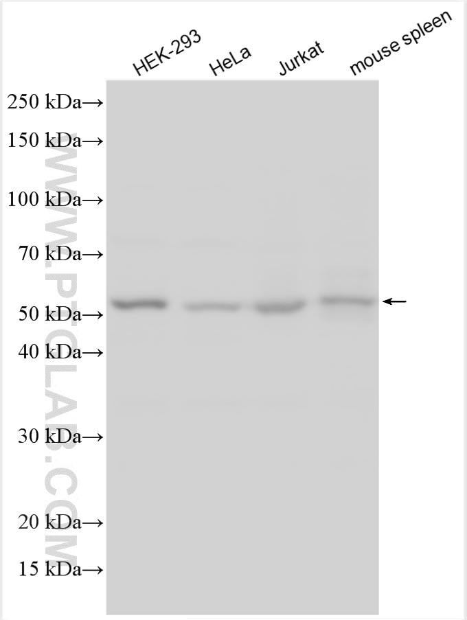 Western Blot (WB) analysis of various lysates using PFKFB3 Polyclonal antibody (13763-1-AP)