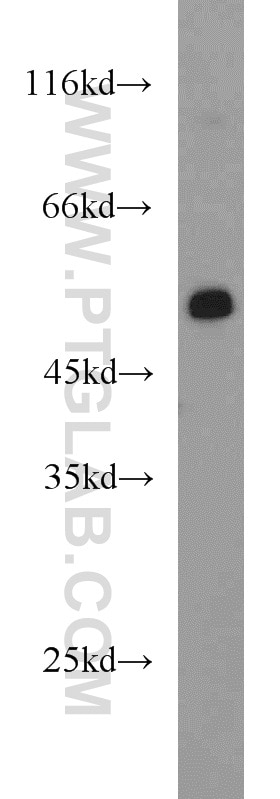 Western Blot (WB) analysis of mouse heart tissue using PFKFB3 Polyclonal antibody (13763-1-AP)