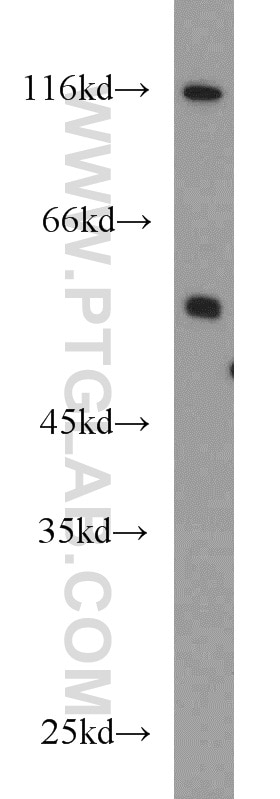 Western Blot (WB) analysis of A431 cells using PFKFB3 Polyclonal antibody (13763-1-AP)