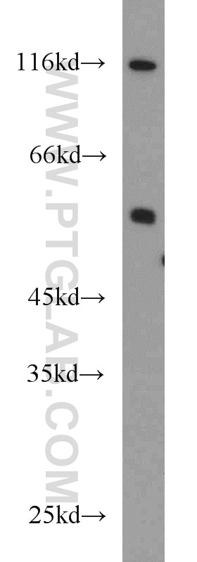 WB analysis of A431 using 13763-1-AP