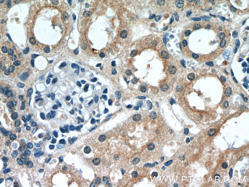 PFKFB3 Monoclonal antibody