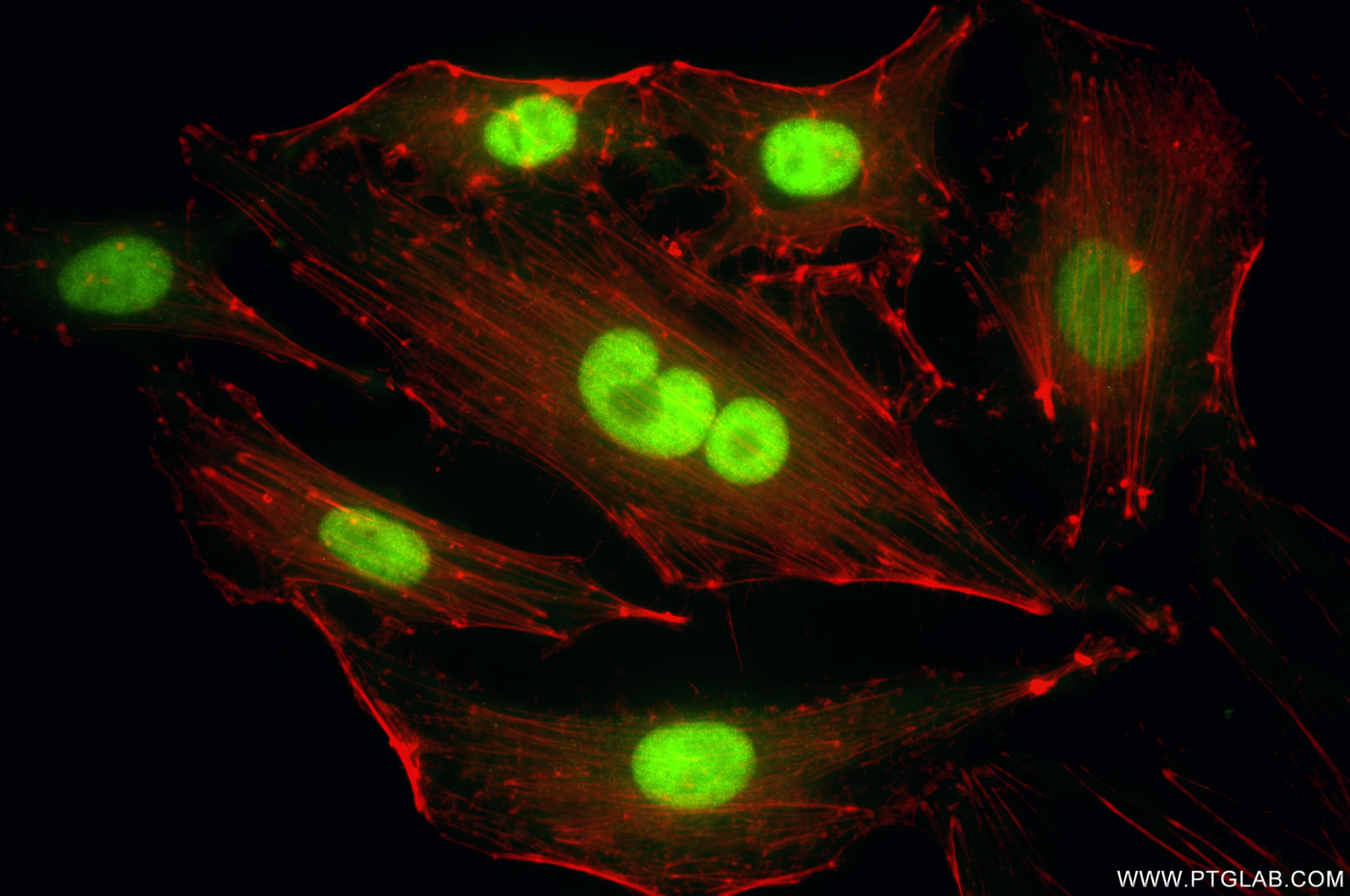 Immunofluorescent analysis of (4% PFA) fixed A549 cells using PFKFB3 antibody (87233-1-RR, Clone: 252490B6 ) at dilution of 1:800 and CoraLite®488-Conjugated Goat Anti-Rabbit IgG(H+L) (SA00013-2), CL594-Phalloidin (red). Immunofluorescence (IF) / fluorescent staining of A549 cells using PFKFB3 Recombinant monoclonal antibody (87233-1-RR)
