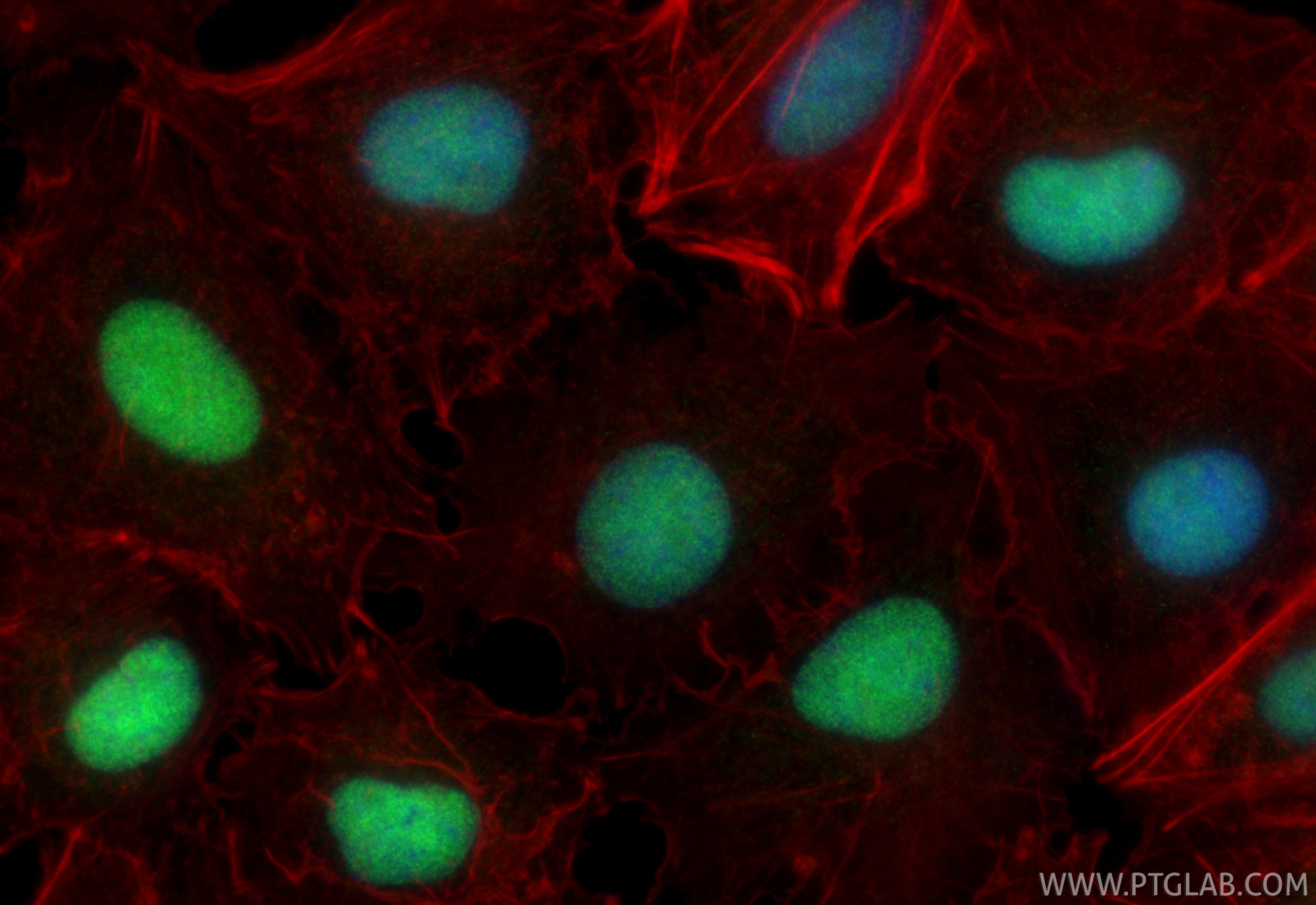 IF Staining of A549 using 87233-1-RR Immunofluorescence (IF) / fluorescent staining of A549 cells using PFKFB3 Recombinant monoclonal antibody (87233-1-RR)