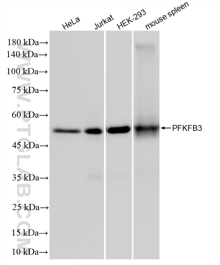 Various lysates were subjected to SDS PAGE followed by western blot with 87233-1-RR (PFKFB3 antibody) at dilution of 1:5000 incubated at room temperature for 1.5 hours. Western Blot (WB) analysis of various lysates using PFKFB3 Recombinant monoclonal antibody (87233-1-RR)
