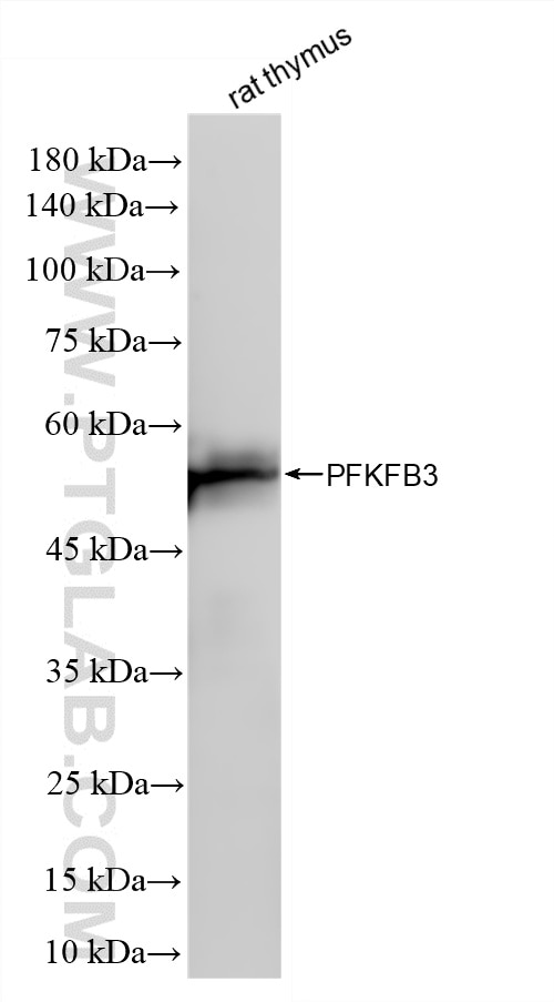 Rat thymus tissue were subjected to SDS PAGE followed by western blot with 87233-1-RR (PFKFB3 antibody) at dilution of 1:5000 incubated at room temperature for 1.5 hours. Western Blot (WB) analysis of rat thymus tissue using PFKFB3 Recombinant monoclonal antibody (87233-1-RR)