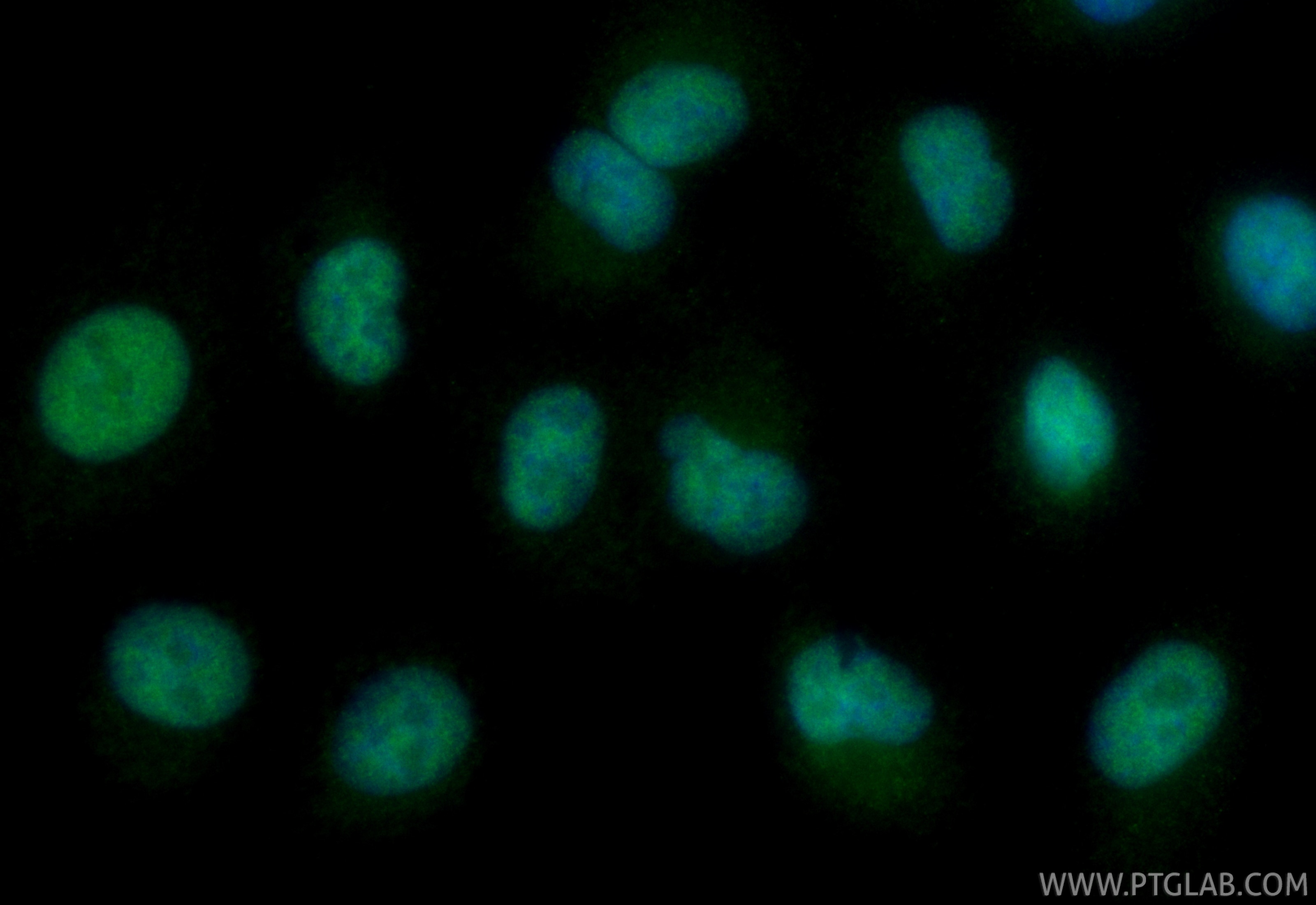 IF Staining of A549 using CL488-87233 Immunofluorescence (IF) / fluorescent staining of A549 cells using CoraLite® Plus 488-conjugated PFKFB3 Recombinant m (CL488-87233)