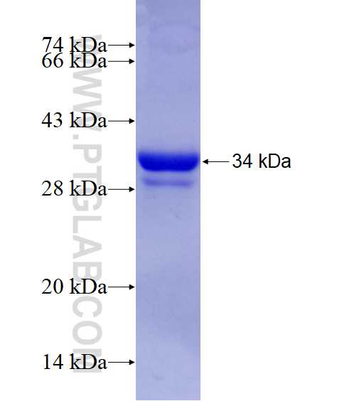 PFKFB3 fusion protein Ag4737 SDS-PAGE