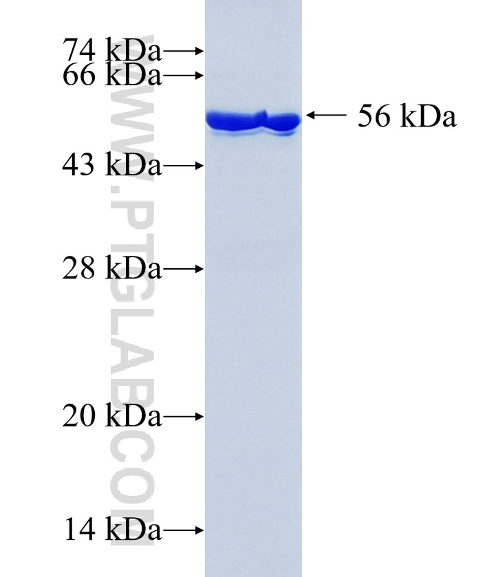 PFKFB3 fusion protein Ag4744 SDS-PAGE