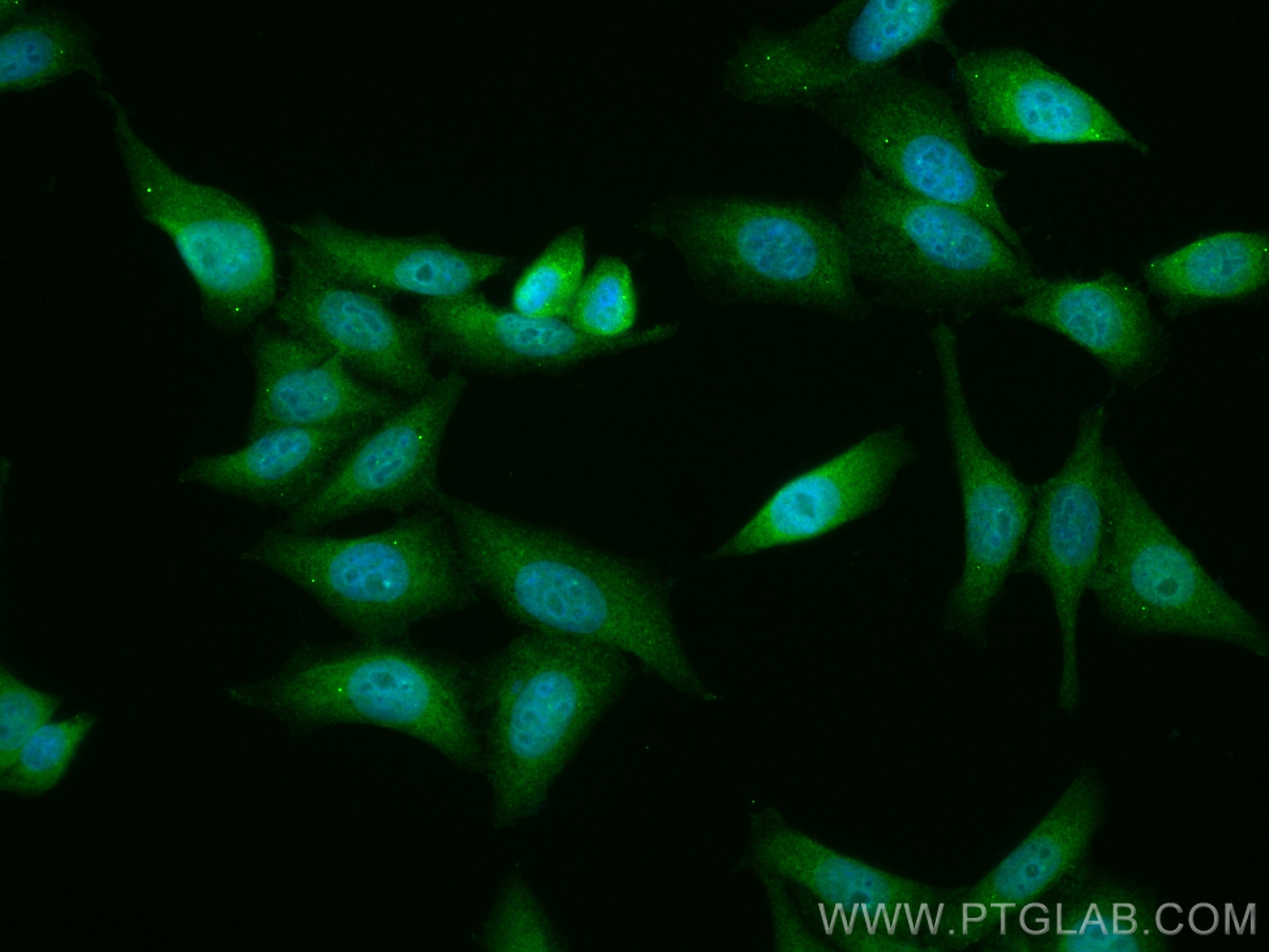 Immunofluorescence (IF) / fluorescent staining of HepG2 cells using CoraLite® Plus 488-conjugated PFKFB3-Specific Poly (CL488-13763)