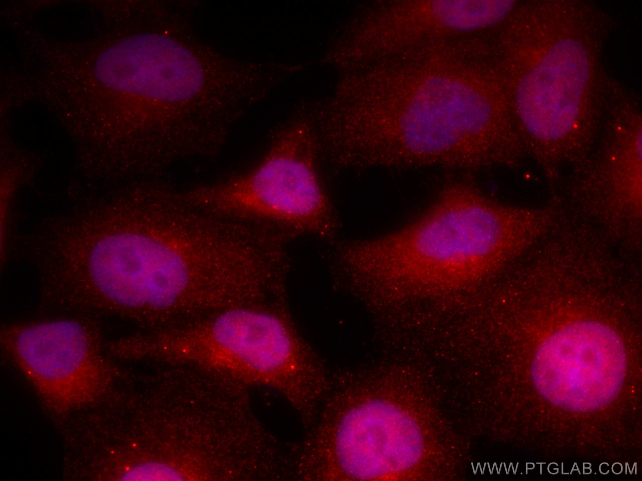 Immunofluorescence (IF) / fluorescent staining of HepG2 cells using CoraLite®594-conjugated PFKFB3-Specific Polyclonal (CL594-13763)