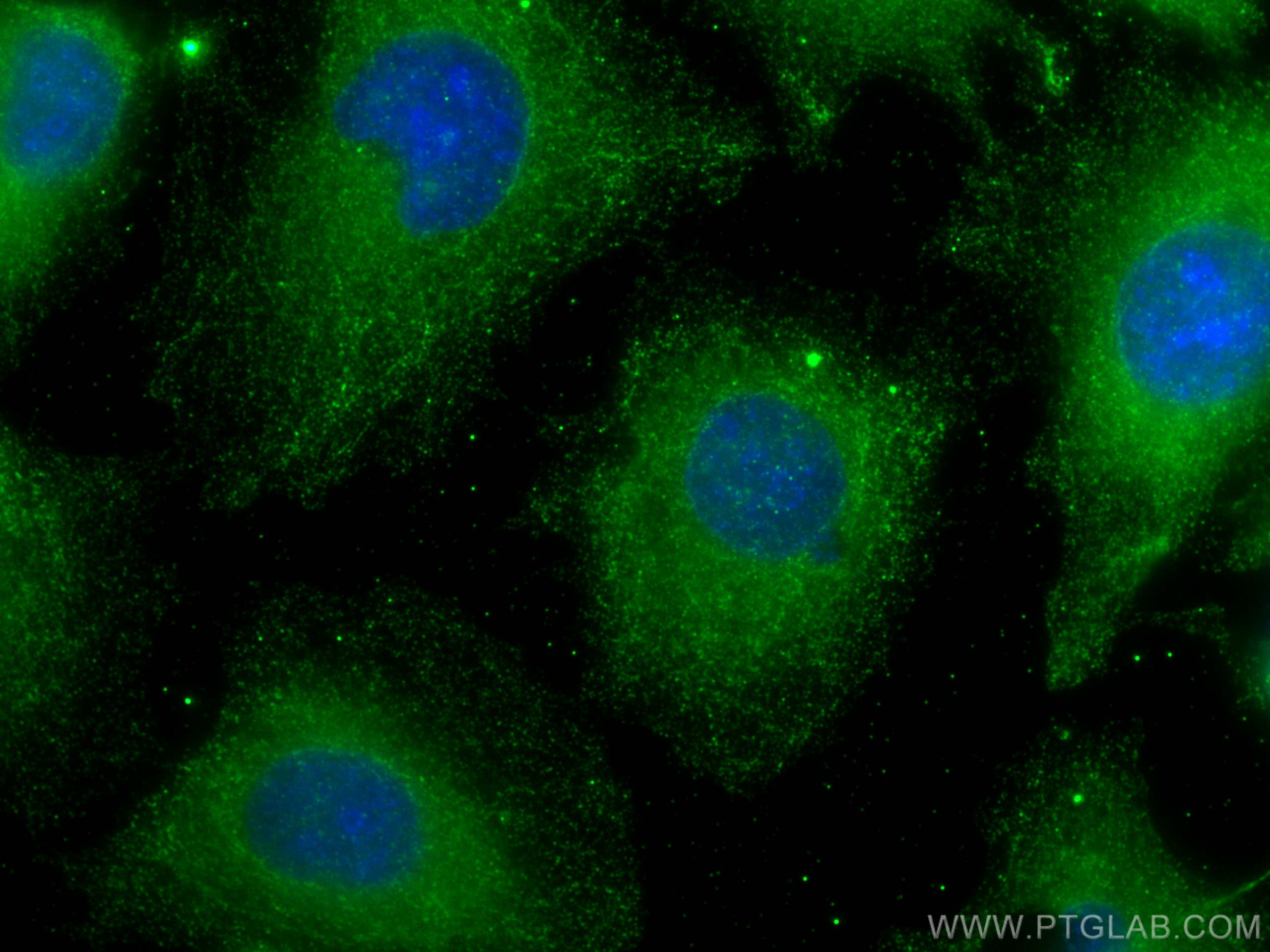 Immunofluorescence (IF) / fluorescent staining of HUVEC cells using PFKFB4 Polyclonal antibody (29902-1-AP)