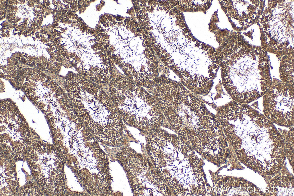 Immunohistochemistry (IHC) staining of mouse testis tissue using PFKFB4 Polyclonal antibody (29902-1-AP)