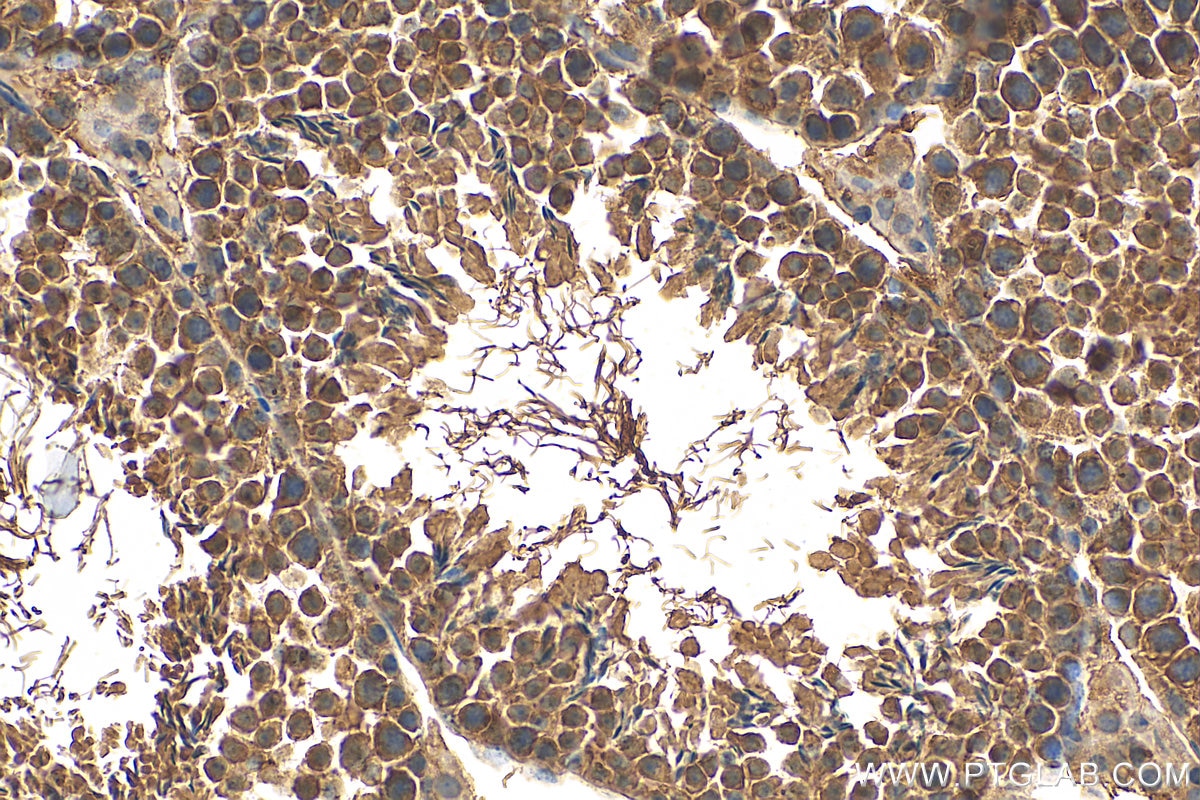 Immunohistochemistry (IHC) staining of mouse testis tissue using PFKFB4 Polyclonal antibody (29902-1-AP)