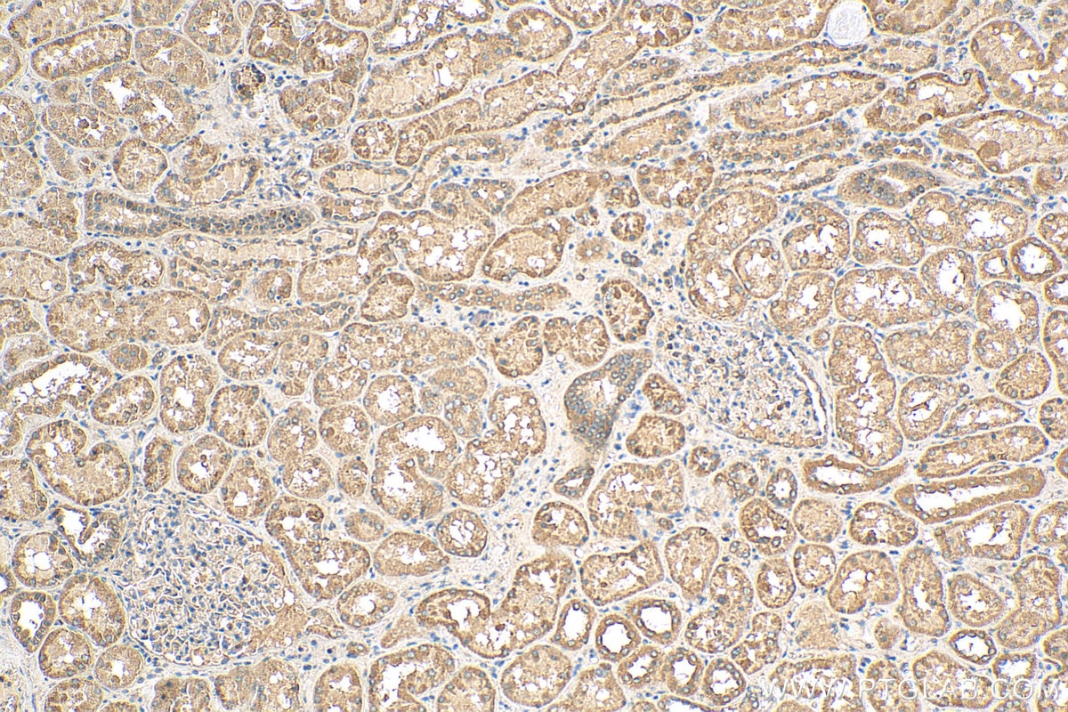 Immunohistochemistry (IHC) staining of human kidney tissue using PFKFB4 Polyclonal antibody (29902-1-AP)