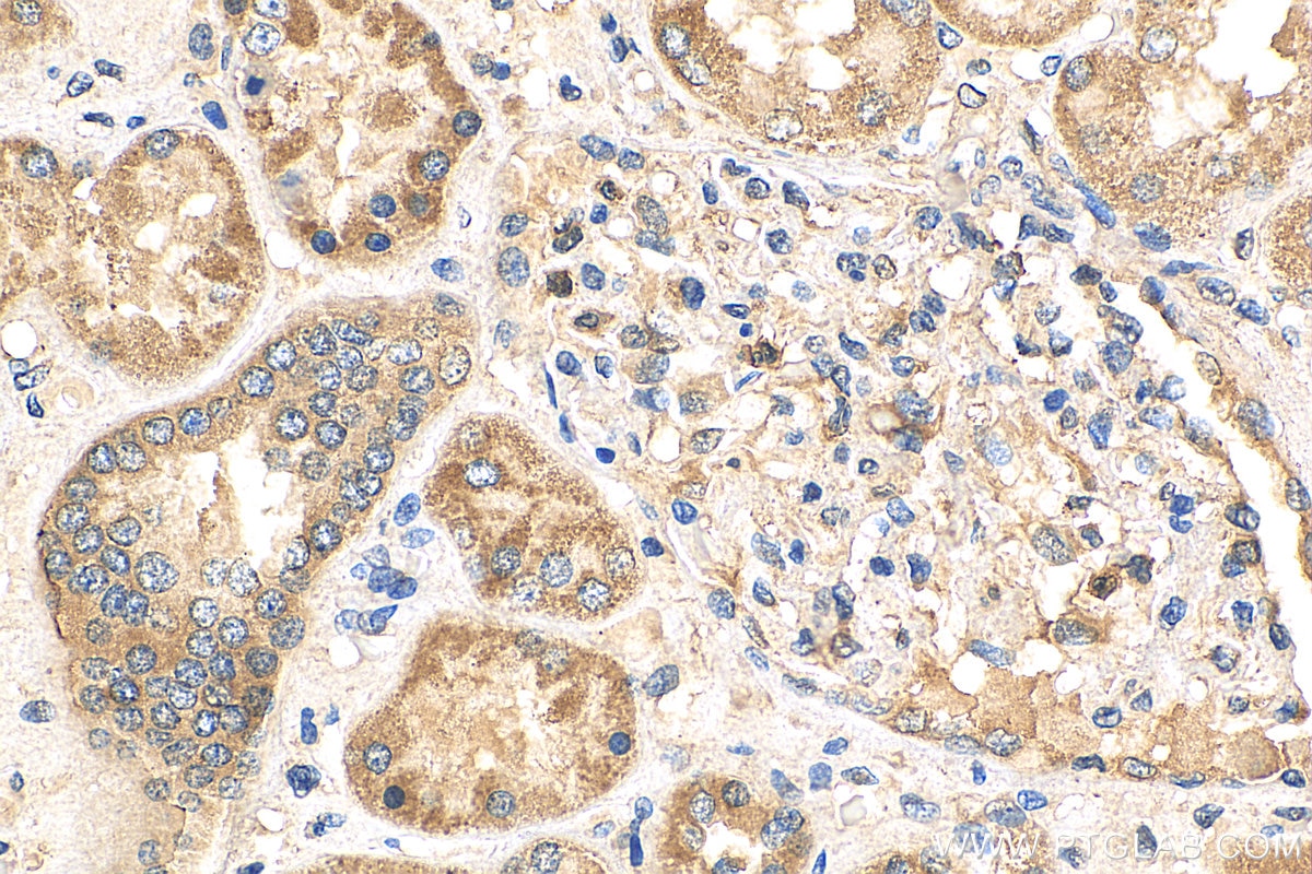 Immunohistochemistry (IHC) staining of human kidney tissue using PFKFB4 Polyclonal antibody (29902-1-AP)