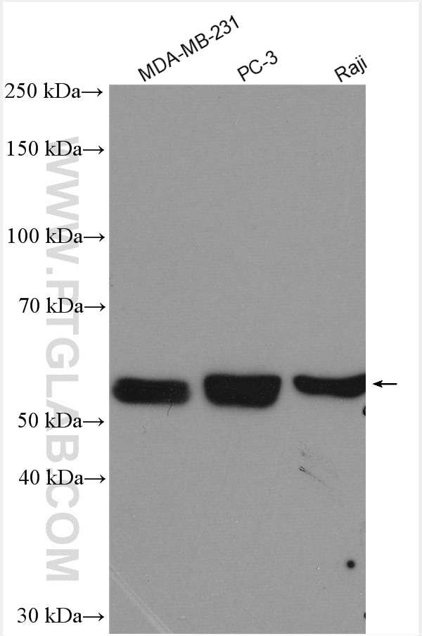 Western Blot (WB) analysis of various lysates using PFKFB4 Polyclonal antibody (29902-1-AP)