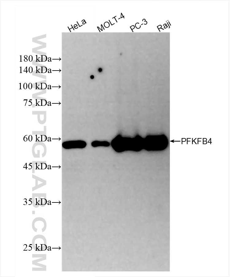 Western Blot (WB) analysis of various lysates using PFKFB4 Recombinant antibody (85444-3-RR)