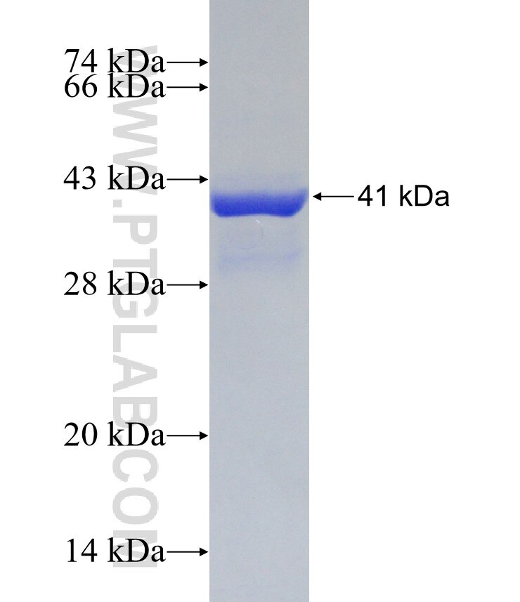 PFKFB4 fusion protein Ag30571 SDS-PAGE