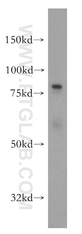 Western Blot (WB) analysis of HeLa cells using PFKL Polyclonal antibody (15652-1-AP)