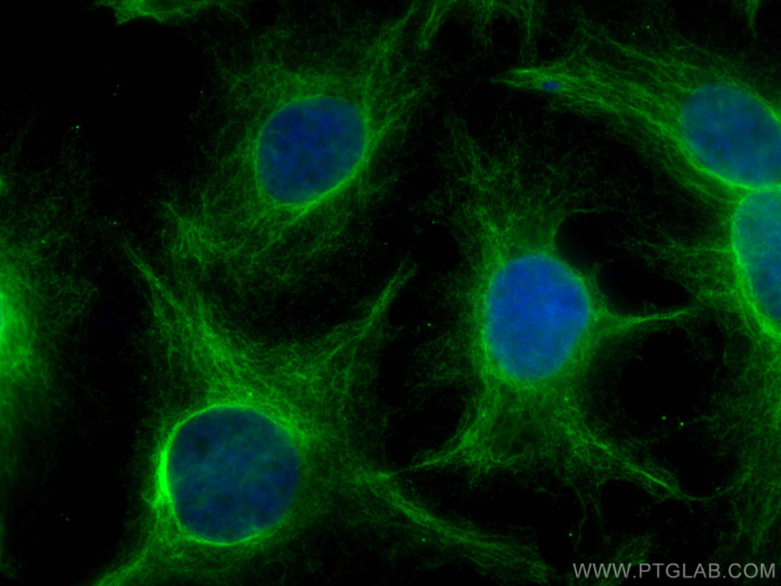 Immunofluorescence (IF) / fluorescent staining of HuH-7 cells using PFKL Monoclonal antibody (68385-1-Ig)