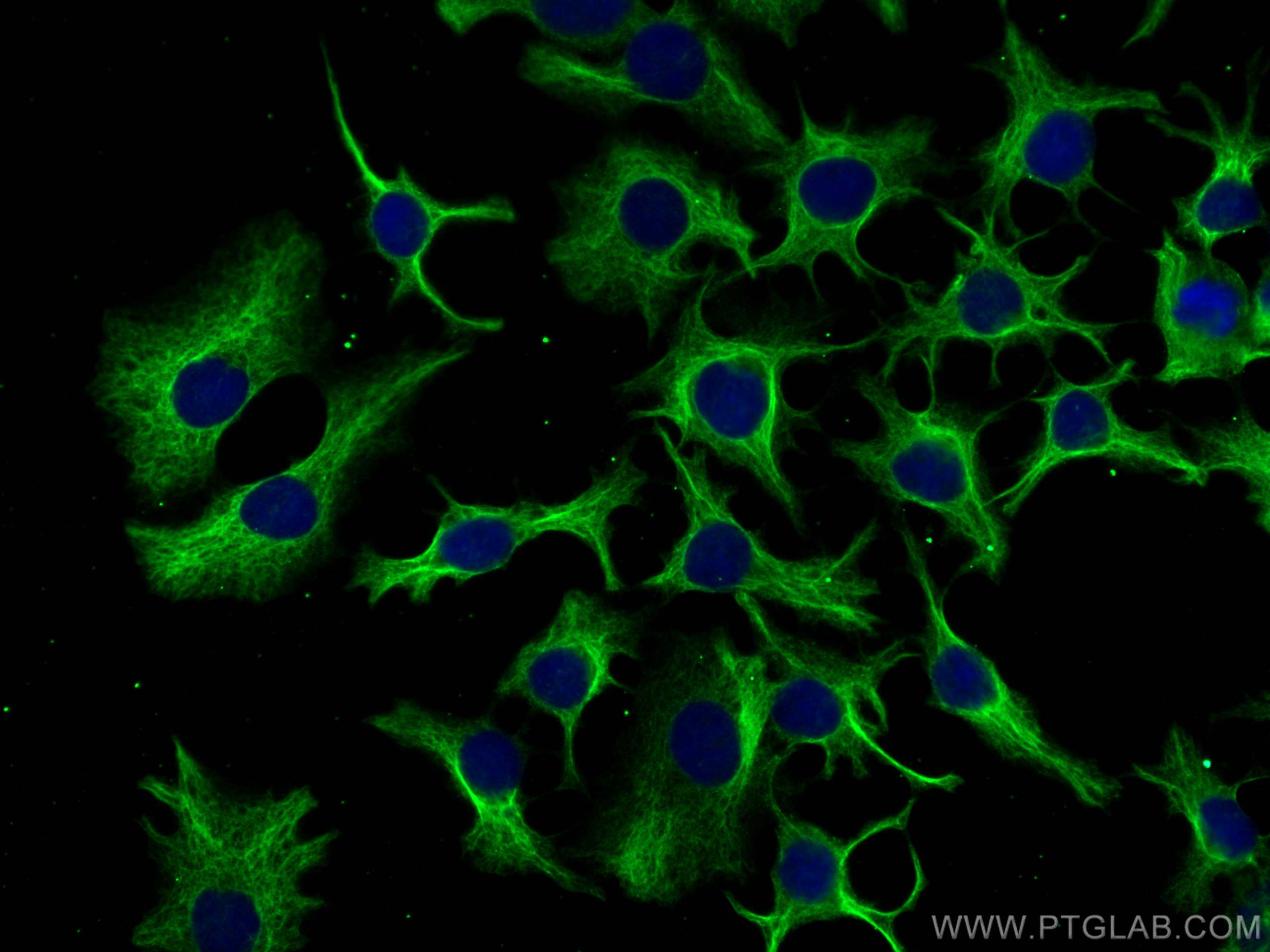 Immunofluorescence (IF) / fluorescent staining of HuH-7 cells using PFKL Monoclonal antibody (68385-1-Ig)