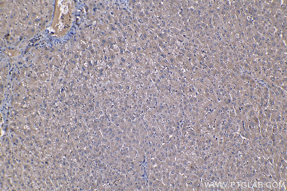 Immunohistochemistry (IHC) staining of human liver tissue using PFKL Monoclonal antibody (68385-1-Ig)