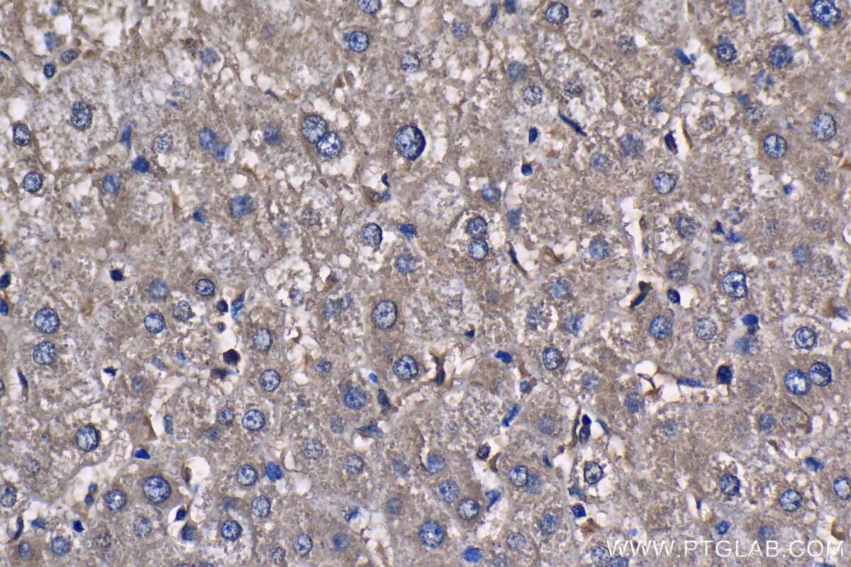 Immunohistochemistry (IHC) staining of human liver tissue using PFKL Monoclonal antibody (68385-1-Ig)