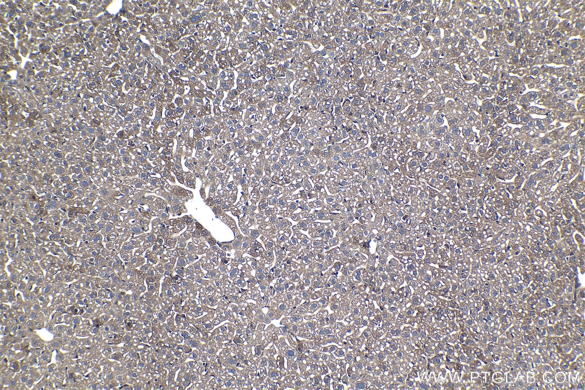 IHC staining of mouse liver using 68385-1-Ig