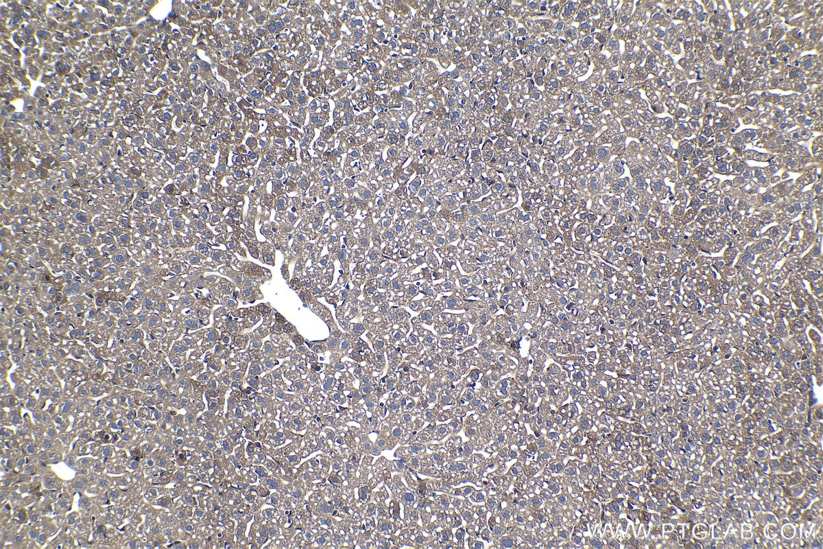 Immunohistochemistry (IHC) staining of mouse liver tissue using PFKL Monoclonal antibody (68385-1-Ig)