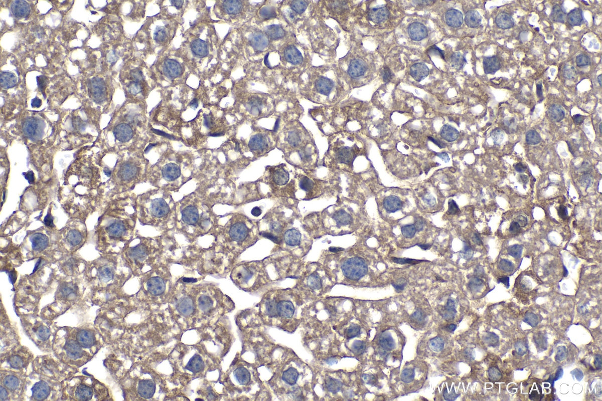 Immunohistochemistry (IHC) staining of mouse liver tissue using PFKL Monoclonal antibody (68385-1-Ig)