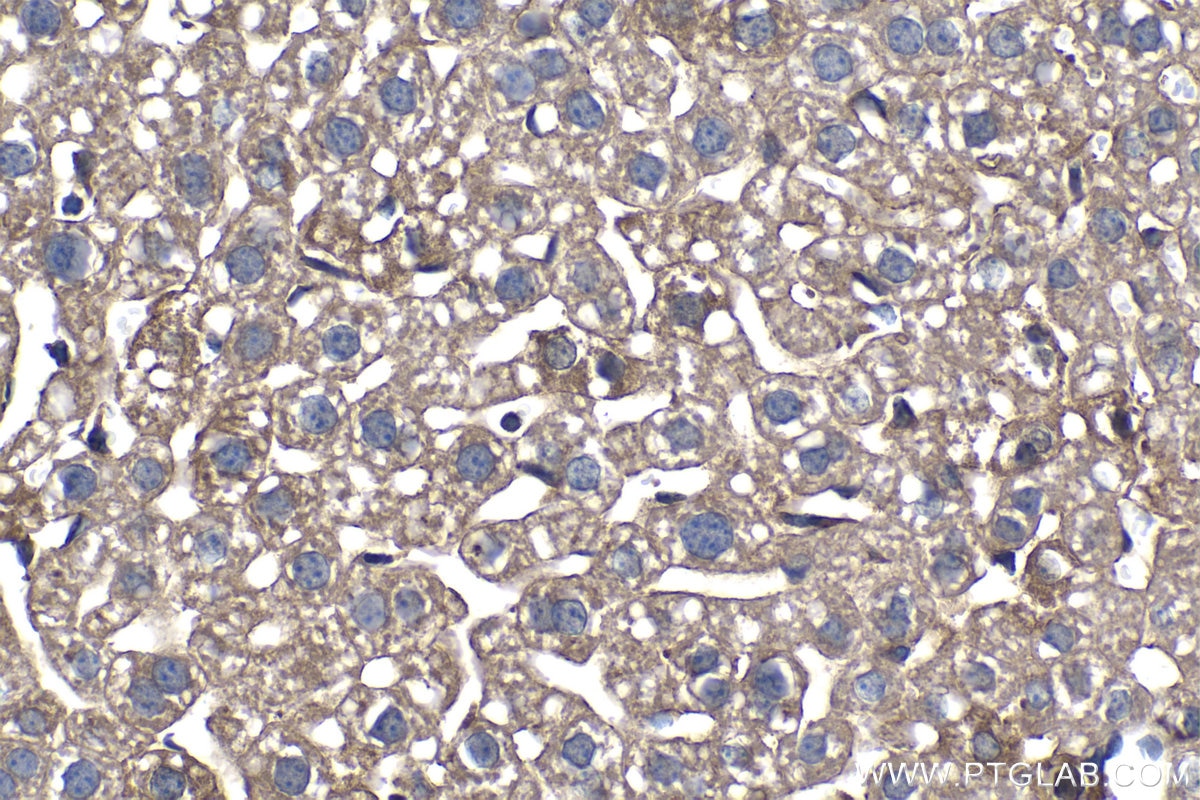 IHC staining of mouse liver using 68385-1-Ig