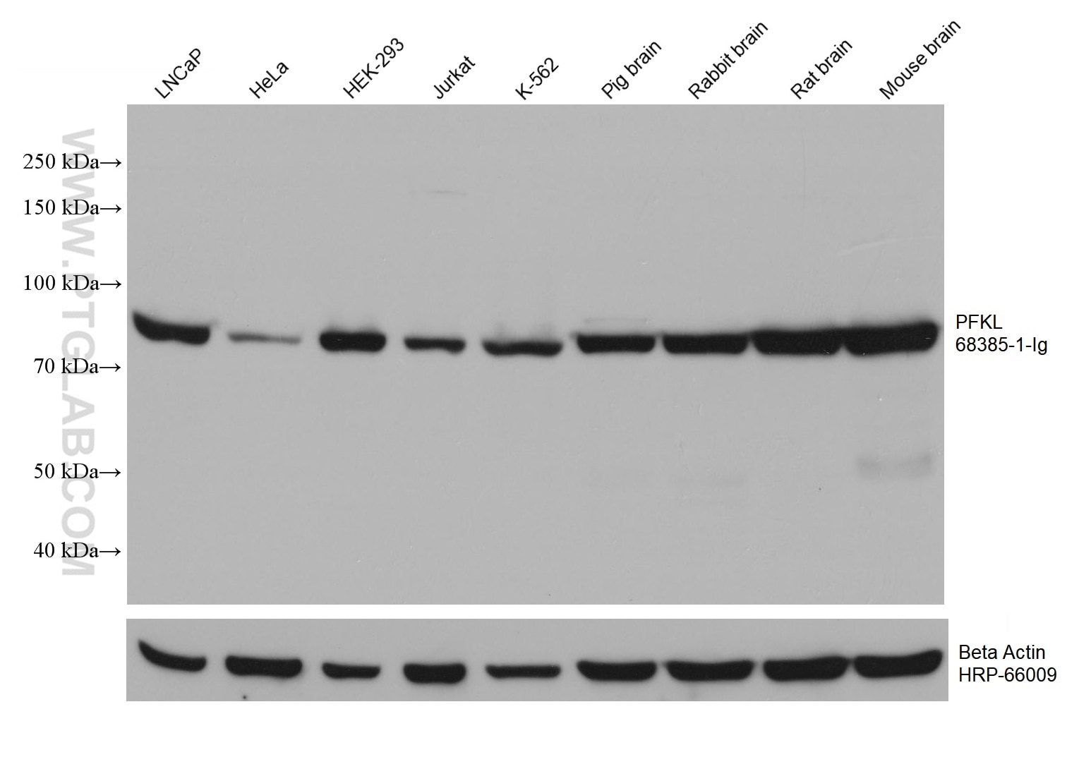 Western Blot (WB) analysis of various lysates using PFKL Monoclonal antibody (68385-1-Ig)