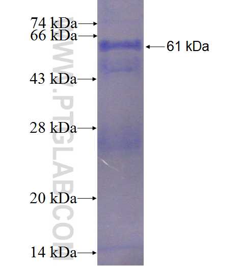 PFKL fusion protein Ag8250 SDS-PAGE