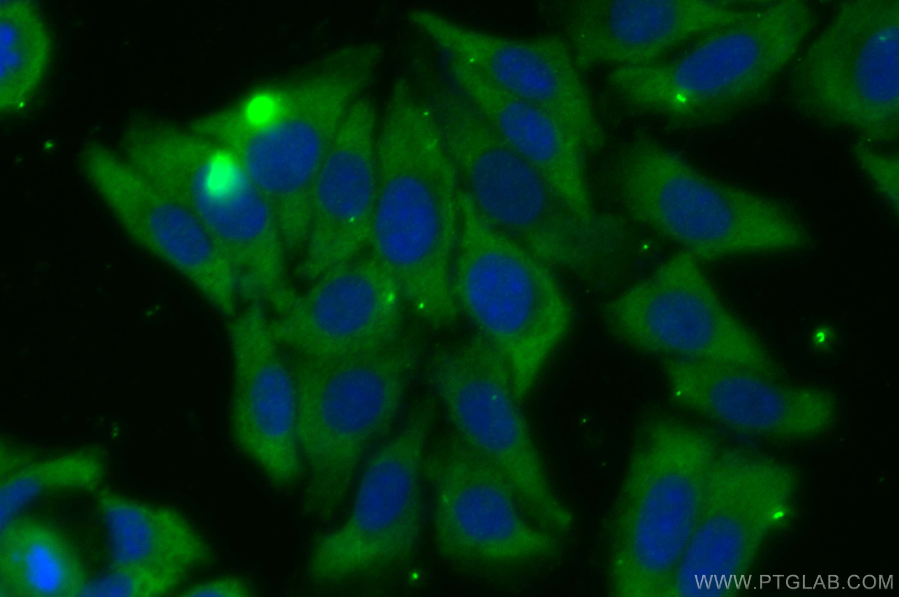Immunofluorescence (IF) / fluorescent staining of HepG2 cells using PFKM Polyclonal antibody (30326-1-AP)