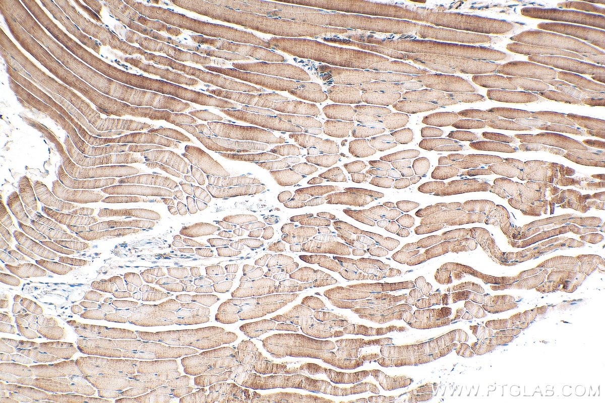 Immunohistochemistry (IHC) staining of mouse skeletal muscle tissue using PFKM Polyclonal antibody (30326-1-AP)