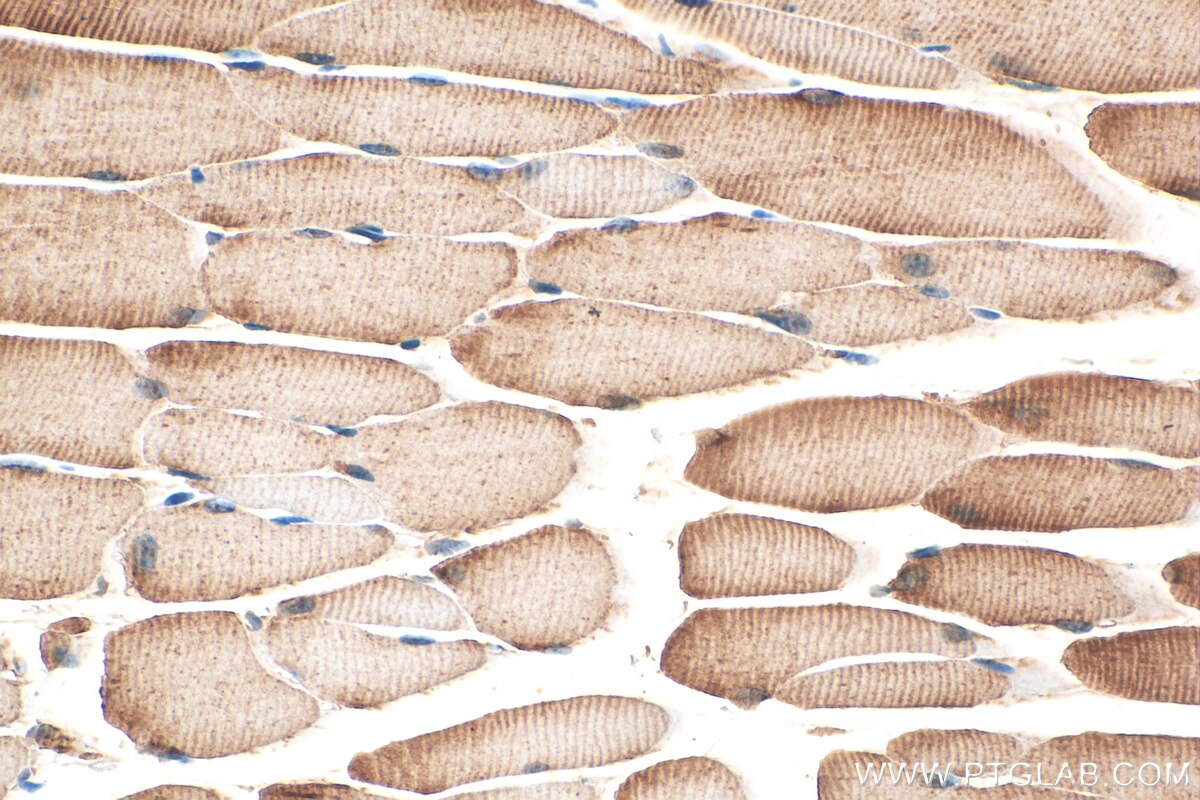 Immunohistochemistry (IHC) staining of mouse skeletal muscle tissue using PFKM Polyclonal antibody (30326-1-AP)