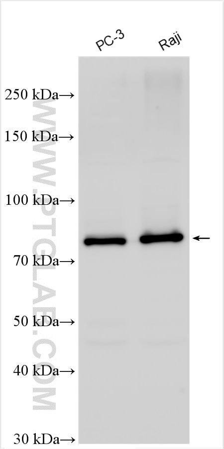 Western Blot (WB) analysis of various lysates using PFKM Polyclonal antibody (30326-1-AP)