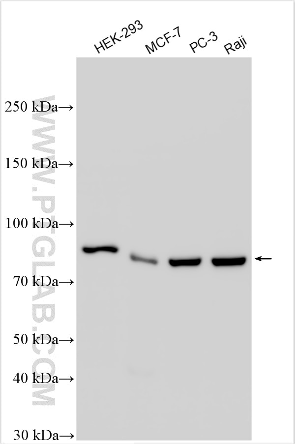 Western Blot (WB) analysis of various lysates using PFKM Polyclonal antibody (30326-1-AP)