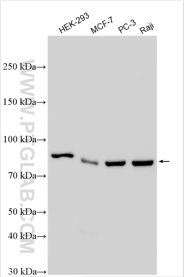 Western Blot (WB) analysis of various lysates using PFKM Polyclonal antibody (30326-1-AP)