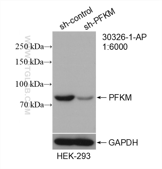 Western Blot (WB) analysis of HEK-293 cells using PFKM Polyclonal antibody (30326-1-AP)