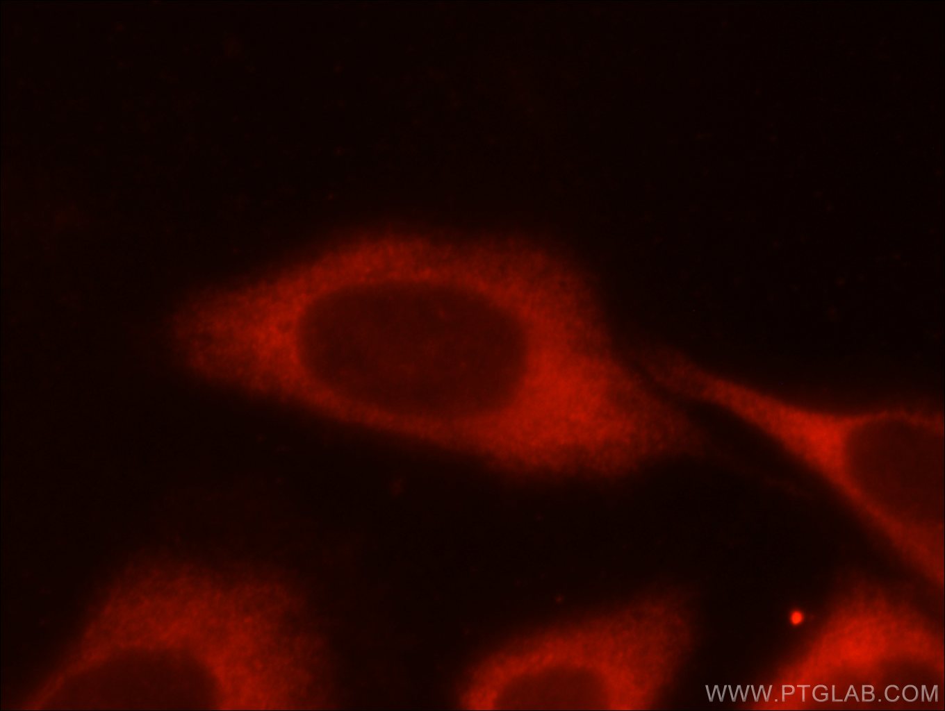 Immunofluorescence (IF) / fluorescent staining of HeLa cells using PFKM Polyclonal antibody (55028-1-AP)